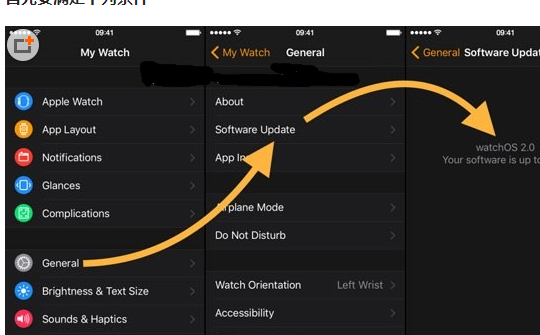 Apple Watchô